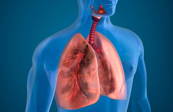 Tìm hiểu về các loại thuốc điều trị bệnh phổi tắc nghẽn mãn tính COPD