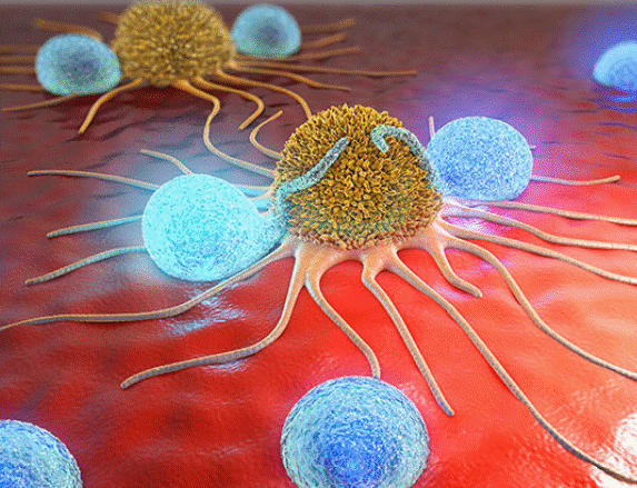 Tế bào NK phát hiện, tiêu diệt tế bào ung thư