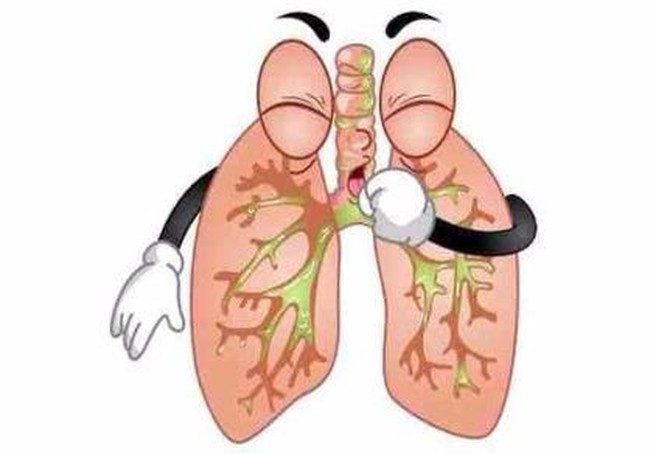 Ho là động tác làm sạch phổi của cơ thể, cũng là dấu hiệu của nhiều vấn đề về đường hô hấp