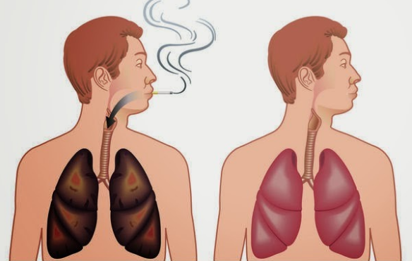 Cách làm sạch phổi sau khi bỏ thuốc lá