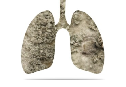 Phổi bị nhiễm độc là nguyên nhân trực tiếp dẫn  đến COPD