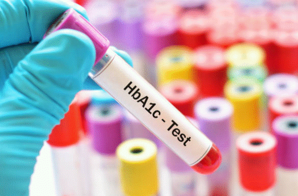 Chỉ số HbA1c là gì và có ý nghĩa như thế nào trong quá trình điều trị bệnh tiểu đường