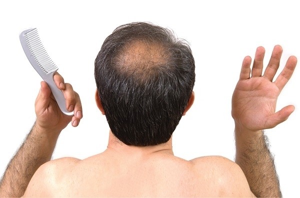 Tìm hiểu hiện tượng rụng tóc nhiều ở nam giới từ A đến Z (cập nhật 2020)
