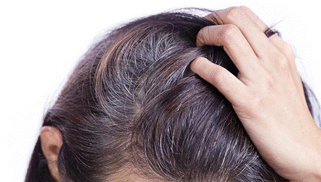 Giải pháp khắc phục bạc tóc an toàn và hiệu quả nhất