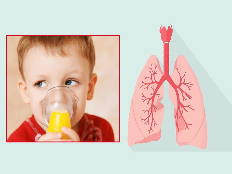 Viêm phế quản có thể dẫn tới hen suyễn ở trẻ