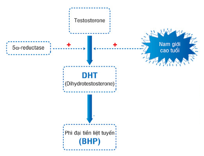 DHT - Nguyên nhân trực tiếp gây phì đại tuyến tiền liệt