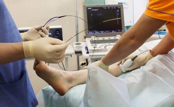 Phương pháp điều trị suy giãn tĩnh mạch chân bằng sóng cao tần