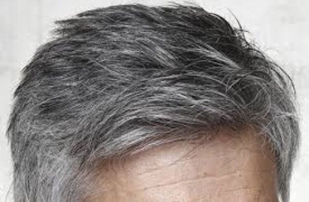 Nguyên nhân tóc bạc sớm và chế độ ăn uống cho người bị bạc tóc