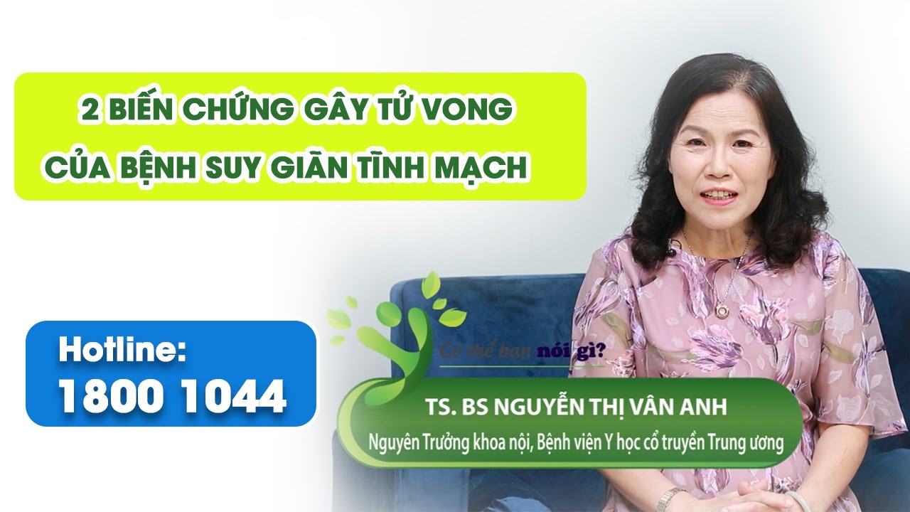 VTV2 - 2 biến chứng gây tử vong của bệnh suy giãn tĩnh mạch